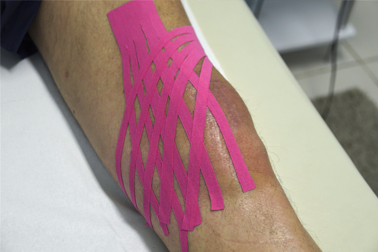 applicazioni kinesio taping